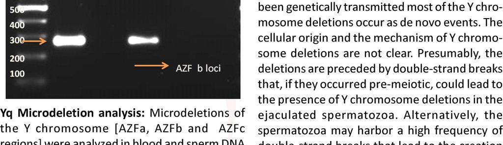 (fsh size, 2- AZF b deleted infertile men, 3- AZF c deleted level=9.6 miu/l) and had severe oligozoosperinfertile men, 4-Positive control, 5-Negative control, mia (2.