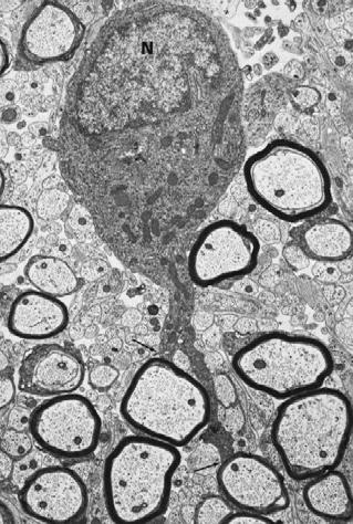 Myelinated axons A myelinating oligodendrocyte