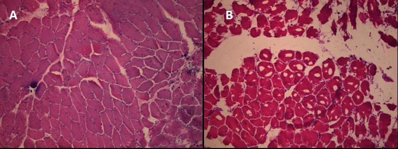 Figure 7 Examples of muscle biopsies prepared for fiber typing. A: High-quality muscle biopsy, fiber typing possible. B: Muscle biopsy with visible artefacts, fiber typing not possible.