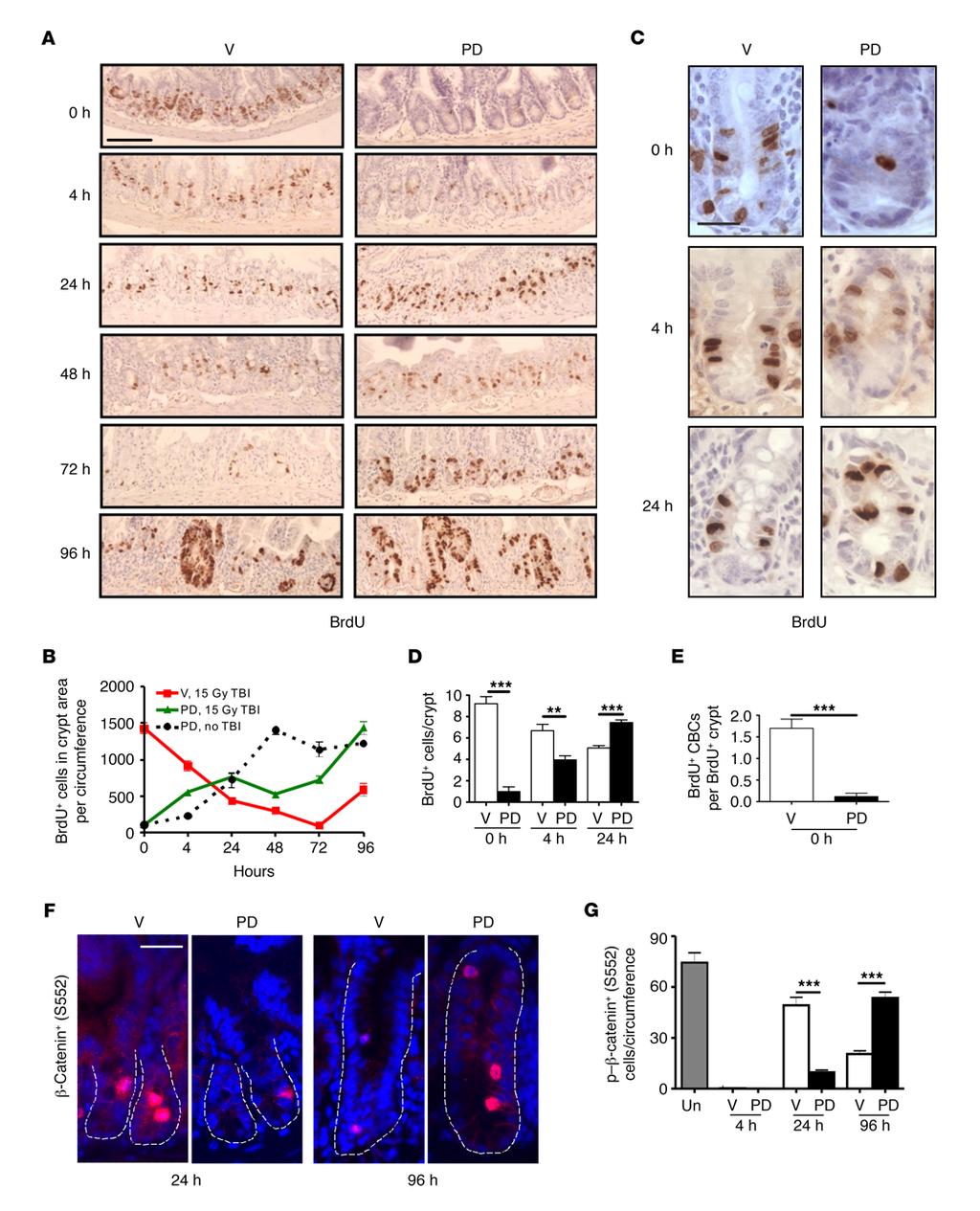 The Journal of Clinical Investigation Figure 2. PD improves crypt regeneration and alters proliferation kinetics. Mice were pretreated with vehicle or PD and subjected to 15 Gy TBI.