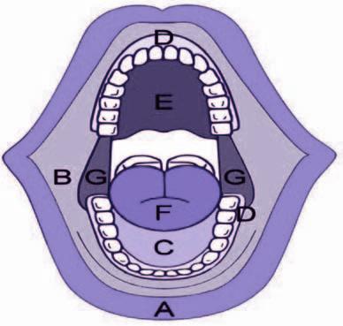 (loco-regional disease) (oral cavity) (circumvillae papillae) (subsite) A (upper & lower lips) B (buccal membrane) C (mouth floor) D (upper & lower gingiva) E (hard palate) F (tongue -- anterior 2/3