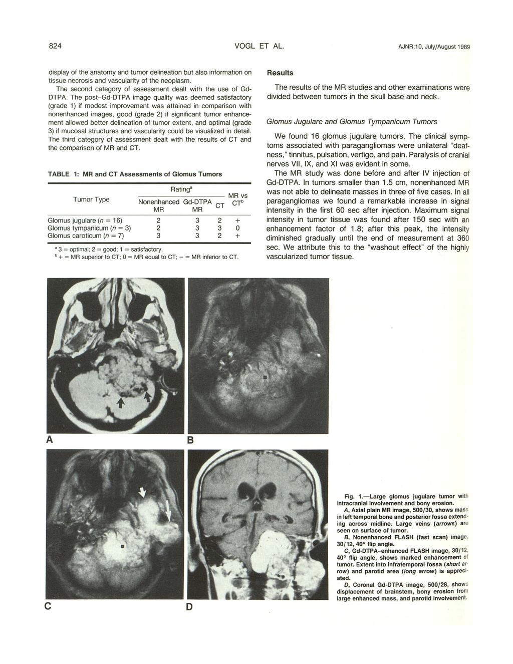 84 VOGL ET AL. AJNR :10, July/August 1989 display of the anatomy and tumor delineation but also information on tissue necrosis and vascularity of the neoplasm.