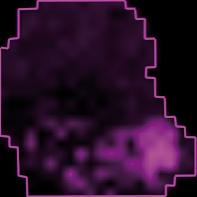 However, there may be more information than expected in the MALDI imaging dataset, because some features may only be visible in the molecular image.