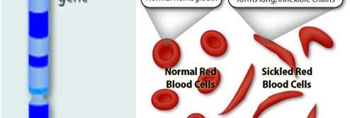 hemoglobin polymerizes under low oxygen conditions
