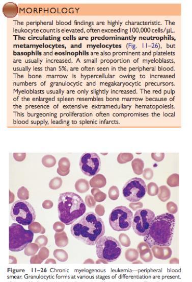 Chronic Myeloproliferative Disorders o Involves the hyperproliferation of neoplastic myeloid progenitors that can terminally differentiate.