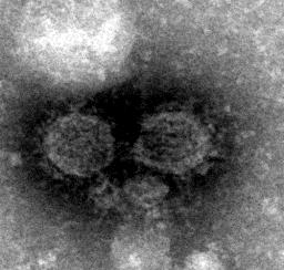 Chikungunya virus (CHIKV)
