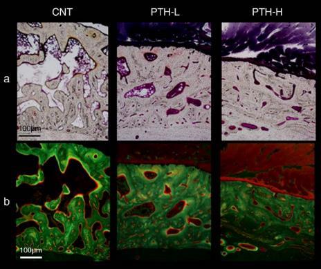 intermittent PTH for another 26 weeks PTH accelerates the natural