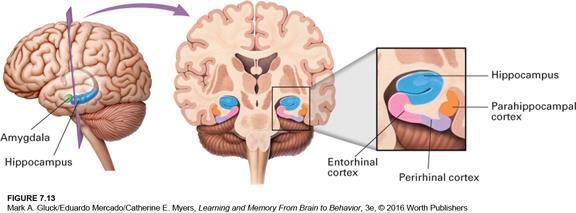 Medial Temporal Lobes H.M. (surgery) & E.P.