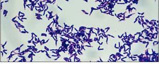 Examples of exotoxin-producing bacteria Corynebacterium diphtheriae (cytotoxin) diphtheria