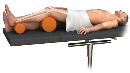 Surgical Technique Patient positioning Position the patient supine on a radiolucent table with the unaffected limb extended away from the affected limb. There should be approximately 10 20 of flexion.