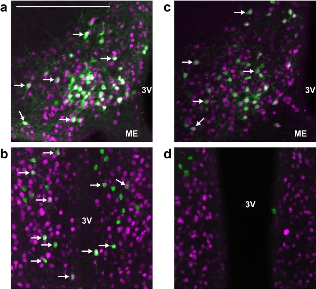 Figure 23 Co-expression of eyfp and ERα in the hypothalamus of male Kiss1 eyfp and Tac2 eyfp mice eyfp and ERα immunoreactivity (pseudocolored green and purple respectively) in the (a) ARC and the