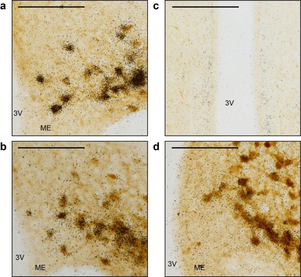 Figure 8 Dual-label in situ hybridization/immunohistochemistry in Tac2 eyfp and Kiss1 eyfp female mice (a) Most eyfp-ir (brown) neurons in the ARC of a female Tac2 eyfp mouse express Tac2 mrna (black
