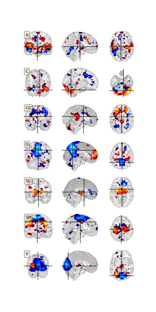 Figure 3.8 Illustrations of sub-networks: visual, auditory, DMN, sensorimotor, subcortical, and cerebellum.