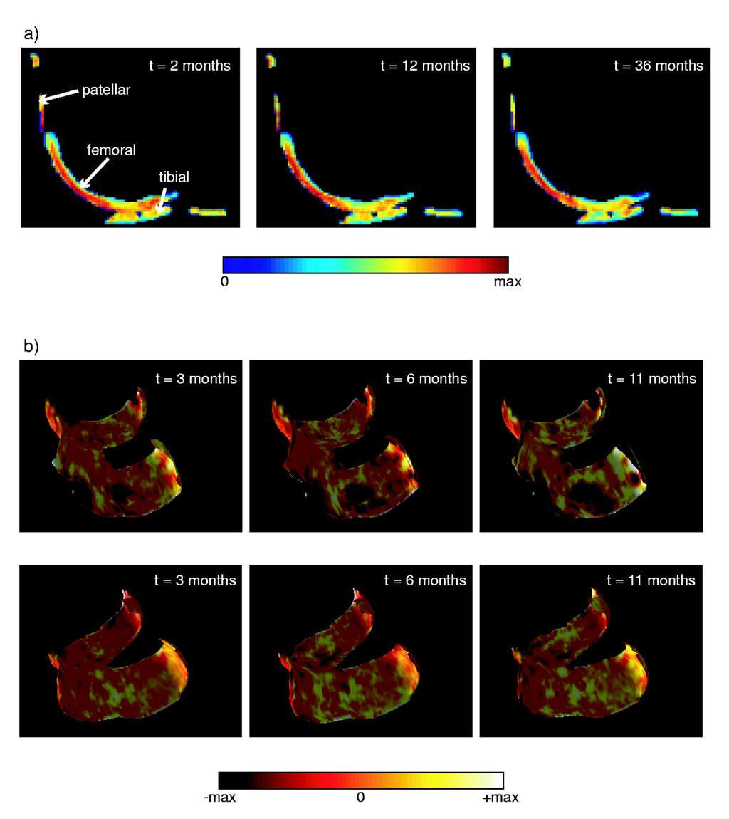 A Method to Monitor Local Changes in MR Signal Intensity 963 Fig. 3. a) Slice through registered and normalised cartilage compartments for three time points.