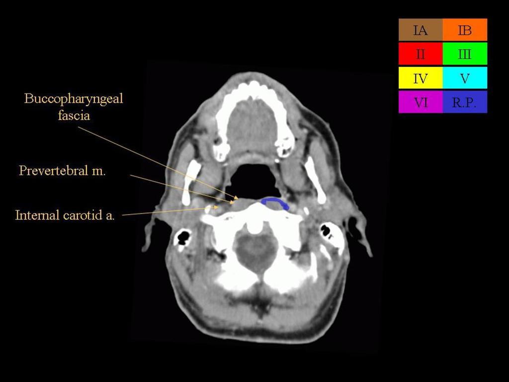 Fig. 5: Axial CT image with