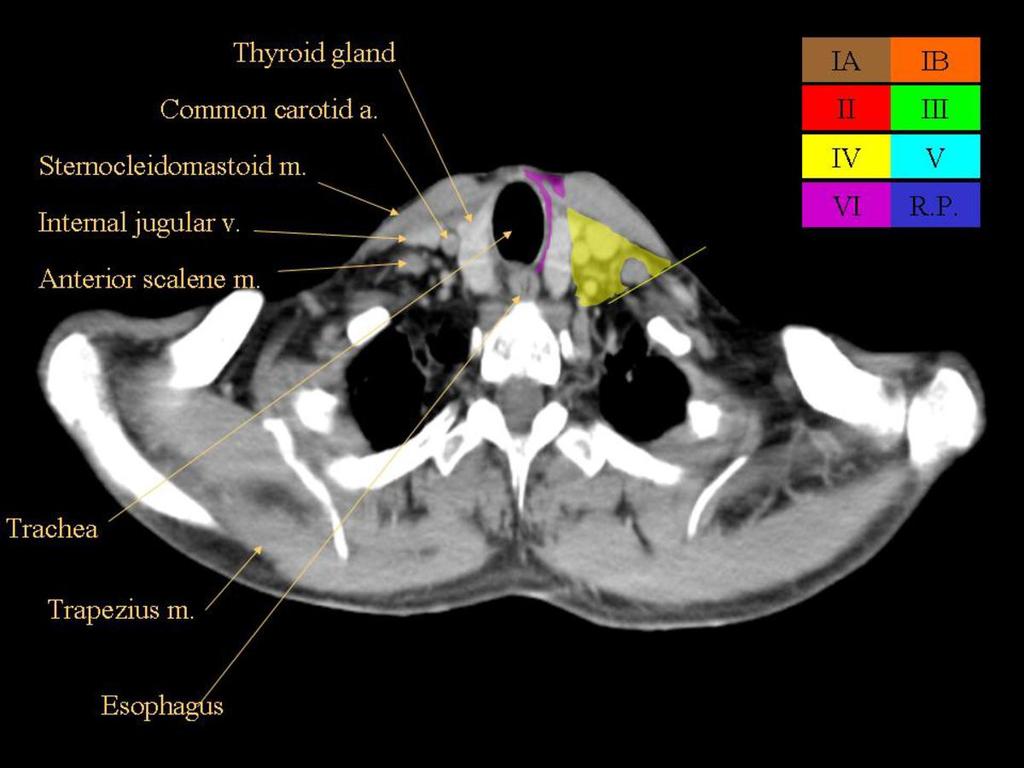 Fig. 30: Axial CT image with