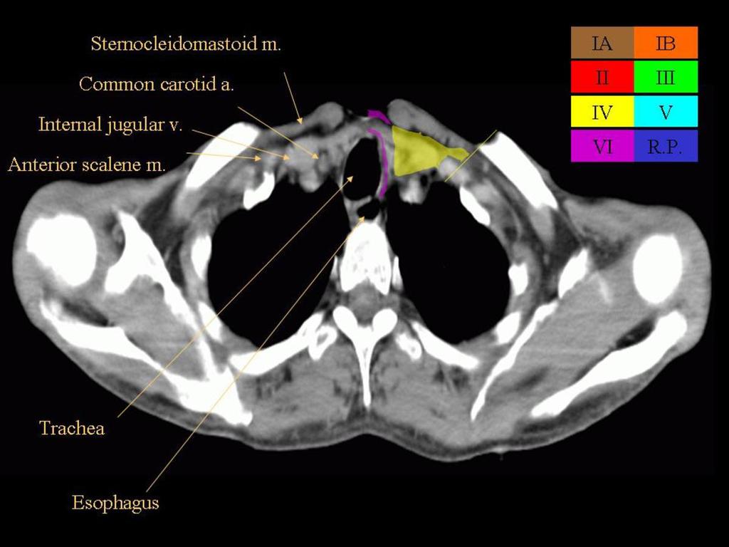 Fig. 33: Axial CT image with