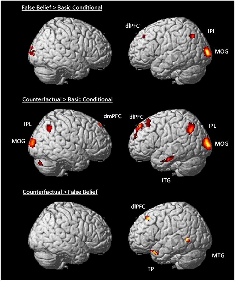Counterfactuals and social cognition Counterfactual thought engages the same network of specialized