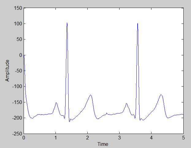 A. RC Low-pass filter: A RC low-pass filter of order 6 having cutoff frequency 150 rad/sec is used. The filtered ECG signal is shown in Fig.4and FFT analysis of filtered signal is shown in Fig.5: Fig.