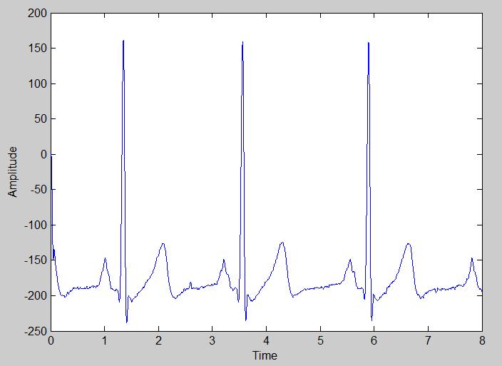 Low-pass filter using Chebyshev approximation: Fig.5. FFT analysis of Simple RC Low-pass Filtered ECG B.