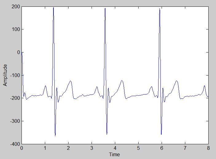 After calculation it is found that the minimum order of the filter is 4. The filtered ECG signal is shown in Fig.8and FFT analysis of filtered signal is shown in Fig.