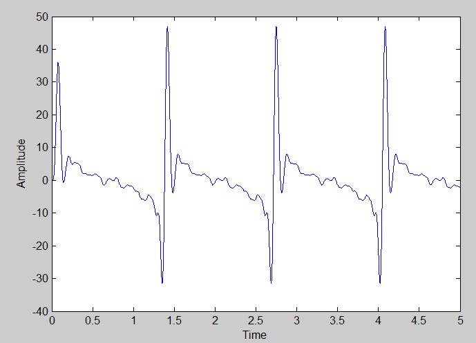 FFT analysis of Low-pass filter using Butterworth approximation C.