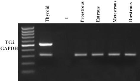 strongly detected in thyroid tissue. Results Amplification of TG gene by RT-PCR As a housekeeping gene, GAPDH was used as an internal control for mrna extraction and cdna synthesis.