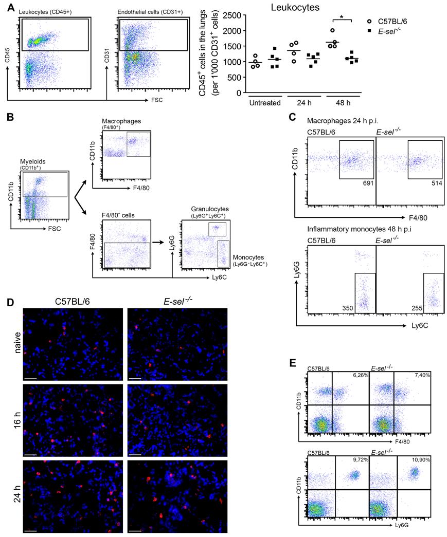 Fig. S2. A) Flow cytometry analysis of leukocyte populations in lungs of tumor cellinjected mice.