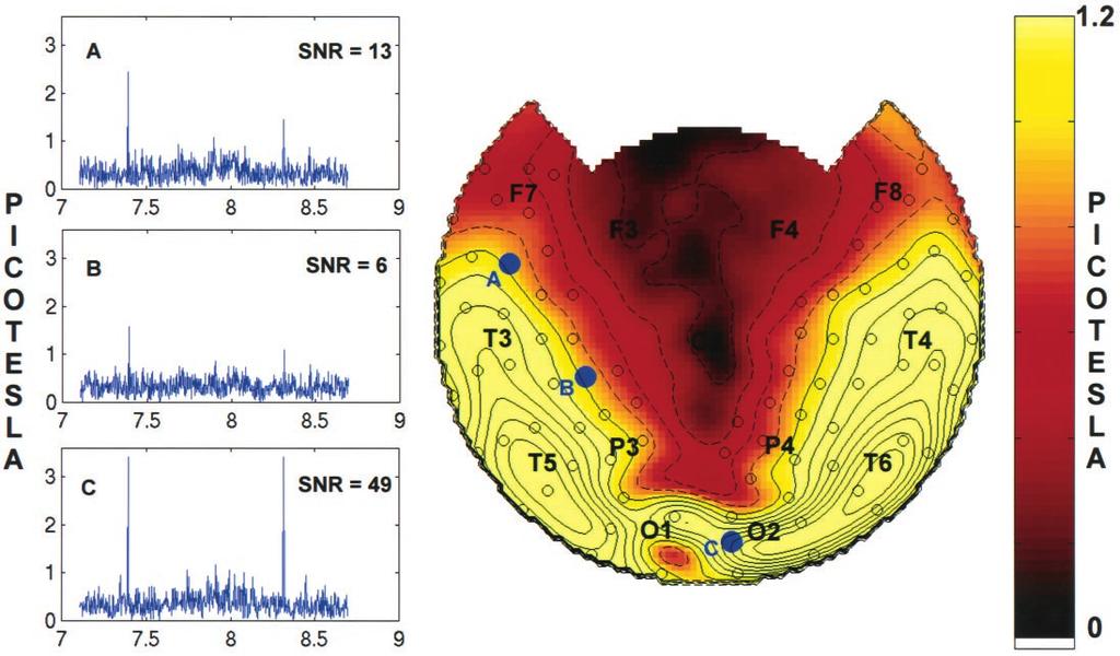 Srinivasan et al. Increased Synchronization during Conscious Perception J. Neurosci., July 1, 1999, 19(13):5435 5448 5439 Figure 2. Left, Amplitude spectra of a single rivalry trial in subject J.S. at MEG sensors located over the left frontal ( A), left parietal-central ( B), and right occipital (C) cortex.