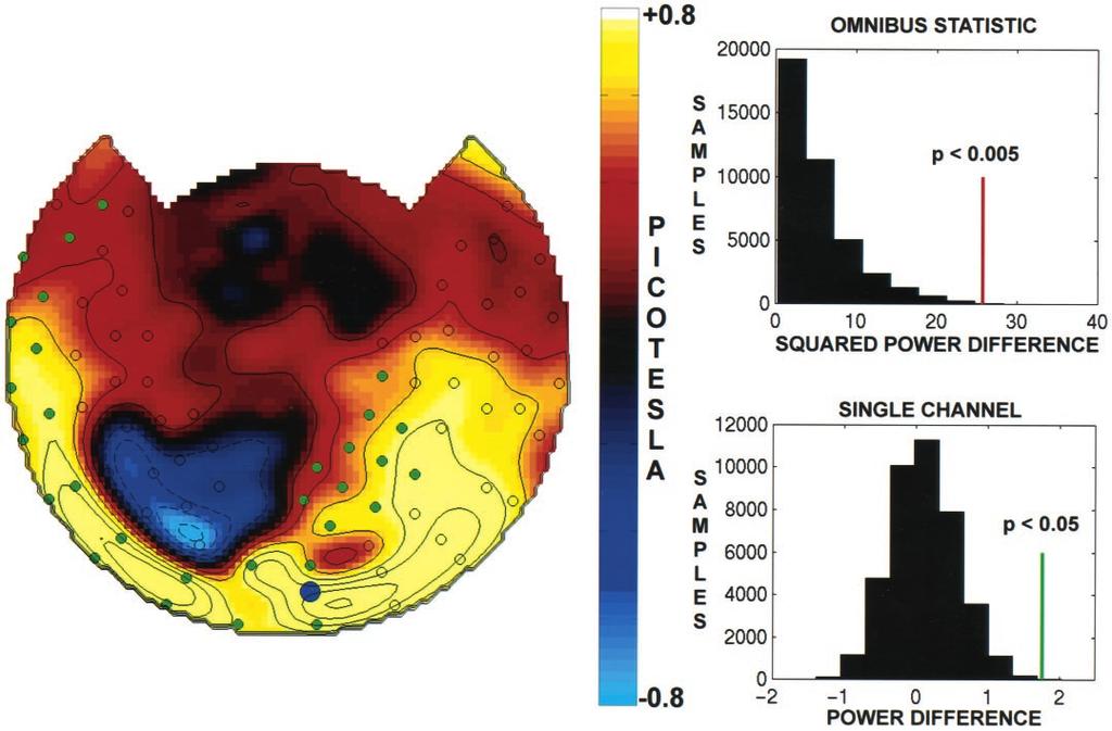 Srinivasan et al. Increased Synchronization during Conscious Perception J. Neurosci., July 1, 1999, 19(13):5435 5448 5441 Figure 4. Left, Topographic display of amplitude differences ( A) atf c 7.