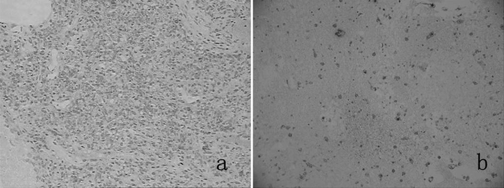 c. Negative staining for α-inhibin in the control tissue (200X). d. Negative staining for Ki-67 in the control tissue (200X). Figure 5.