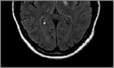 Labs Glucose INR Platelets Imaging Noncontrast head CT vs. CTA/P vs.
