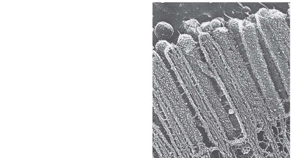Fig. 6-26 Microvillus Plasma membrane