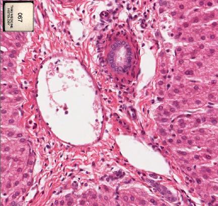 Slide 67: Pig liver Portal triad Hepatic artery