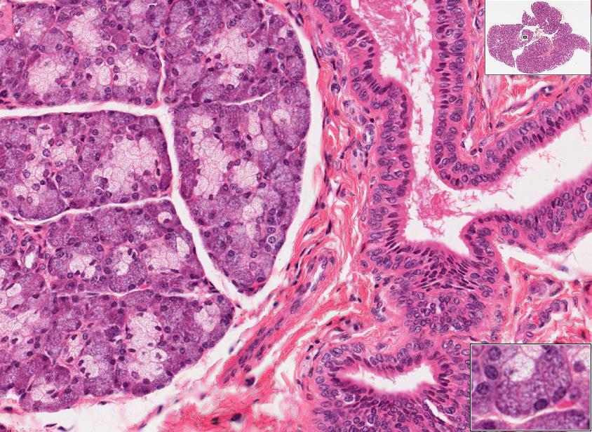 Slide 72 : Submandibular gland Stratified cuboidal/ columnar