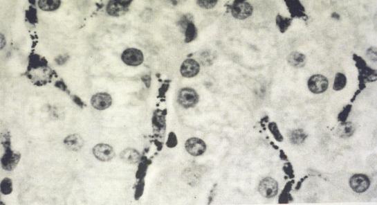 CELLS OF THE LIVER