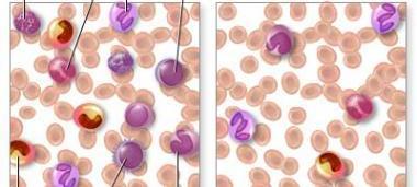 Signs of Blood Infections -Leukocytosis -Leukopenia -Difference between