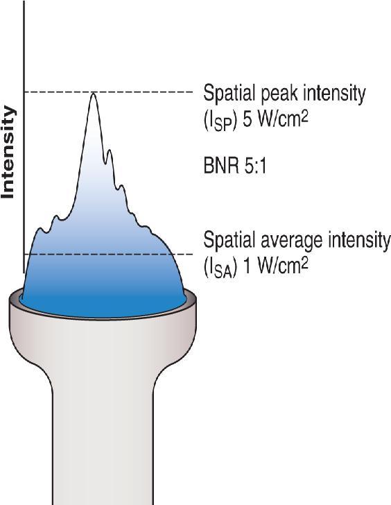 BEAM NON UNIFORMITY RATIO (BNR) BNR is the amount of variability of intensity within the beam of US