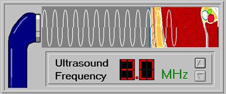1-FREQUENCY US 3MHz:The higher the frequency, less depth of penetration & superficial tissues.