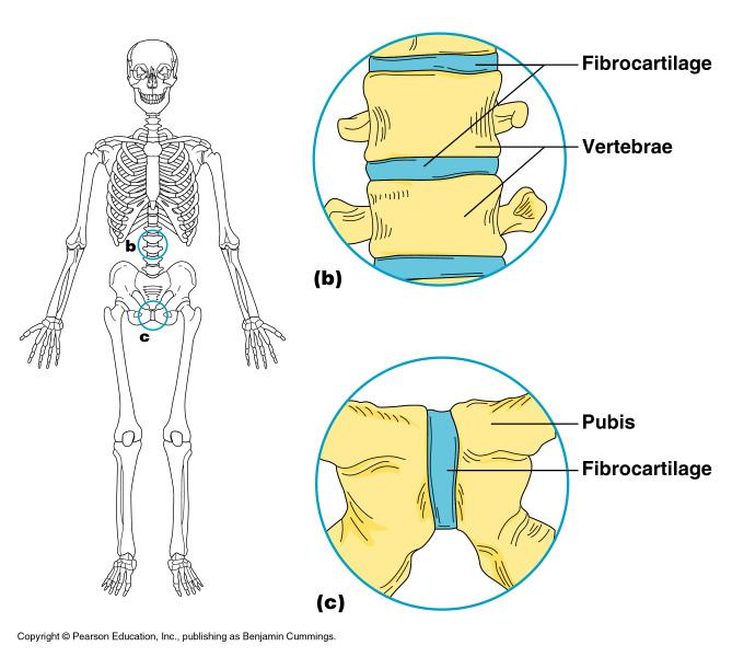 Cartilaginous Joints mostly amphiarthrosis Bones connected by cartilage