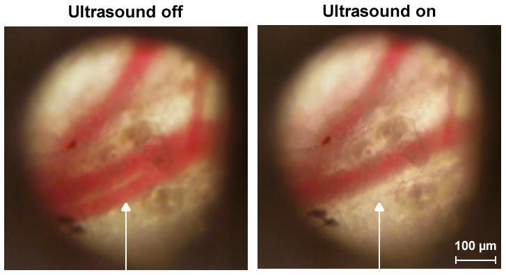 Supplementary Figure 12. In vivo acoustic focusing of blood flow in mouse ear microvessels using the acoustic resonator consisting of two semitubes (Fig. 1a and Fig. S10).