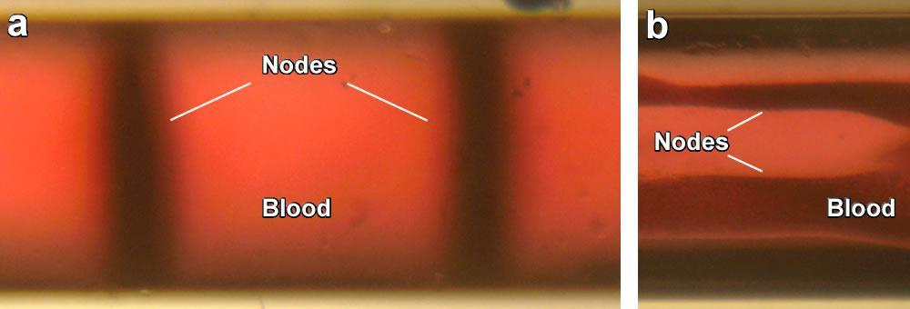 Supplementary Figure 7. In vitro blood concentrating in acoustic nodes in 100- µm glass capillary in flow at a velocity of 5 mm/s. (a) Blood concentration across blood flow.