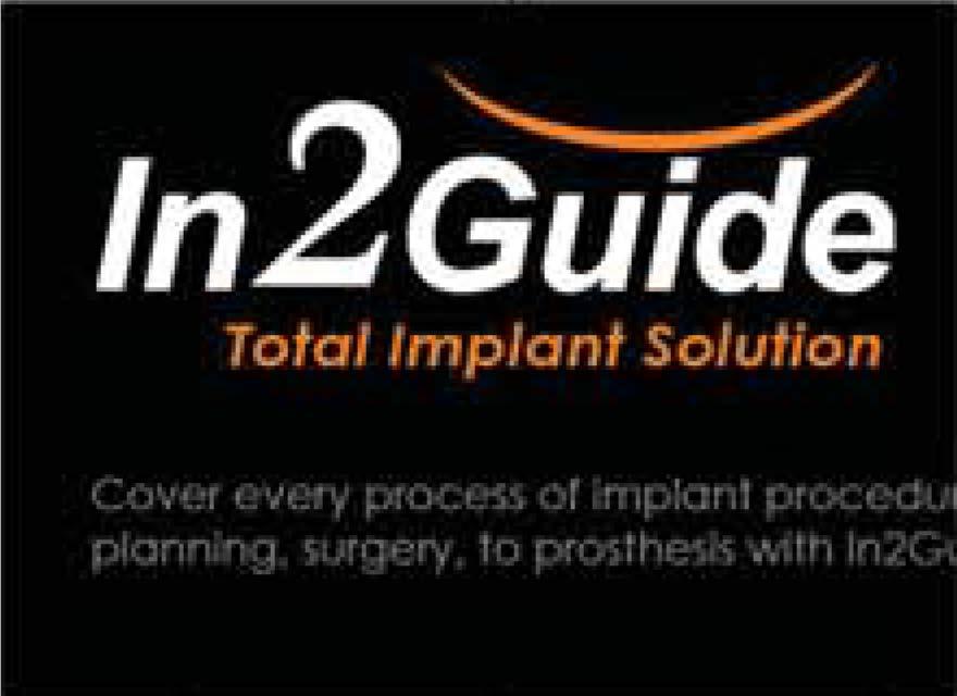 surgery based on virtual wax-up and CBCT merge I OJ Implant software case planning is