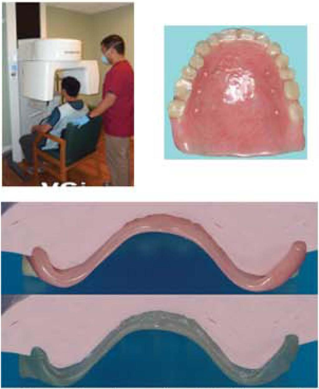 They facilitate the merge of the scanned denture to the CBCT scan.