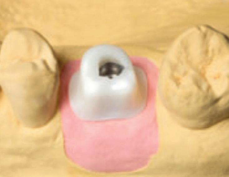 integration implications The combination of two cuttingedge technologies CBCT and CAD/CAM is trailblazing the way to comprehensive implantology.