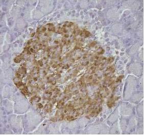 Photograph of Islets of Langerhans and the immunostained area of β cells (40X10 magnification).