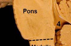 Posterolateral sulcus 11. Decusssation of the pyramids 12. Anterolateral sulcus 13. Lateral funiculus 14. Pyramid 15. Foramen caecum 16.
