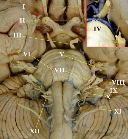 Superficial Attachment Dr of Maha cranial ELbeltagy nerves 1) Olfactory (I) Nerve is formed of about 20 rootlets which pass through the cribriform plate of ethmoid to end in the olfactory bulb.