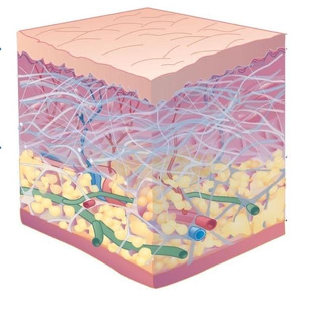 Connective Tissue Disorders >100 different disorders described Result in abnormalities of the extracellular matrix (ECM) Shared features include: Increased flexibility of the skin and joints Variable