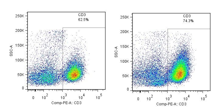 Tumor 1: 78 WF Control Nivolumab Tumor 2: 59 WM Control Nivolumab Comparable CD3 cell population in both tumors CD 3 52.2 42.2 62.5 74.3 Nivolumab binds to PD1 on CD3 cells in both tumors PD 1 24.8 1.